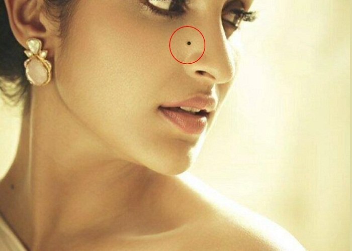 Mark of mole in womens's body