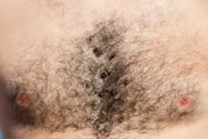 don't believe man who has no chest hair